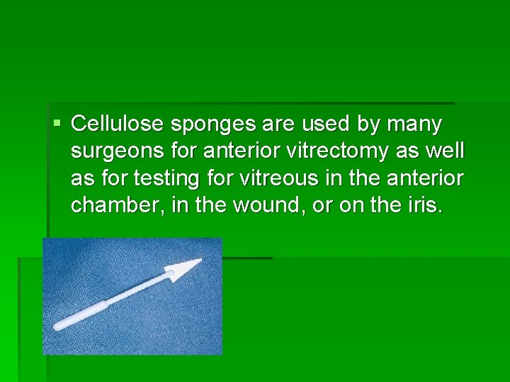 § Cellulose sponges are used by many surgeons for anterior vitrectomy as well as