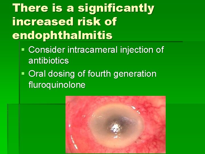 There is a significantly increased risk of endophthalmitis § Consider intracameral injection of antibiotics