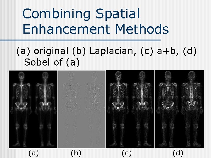 Combining Spatial Enhancement Methods (a) original (b) Laplacian, (c) a+b, (d) Sobel of (a)