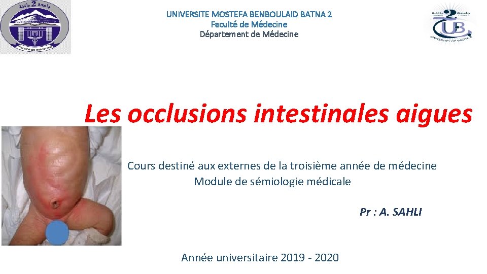 UNIVERSITE MOSTEFA BENBOULAID BATNA 2 Faculté de Médecine Département de Médecine Les occlusions intestinales