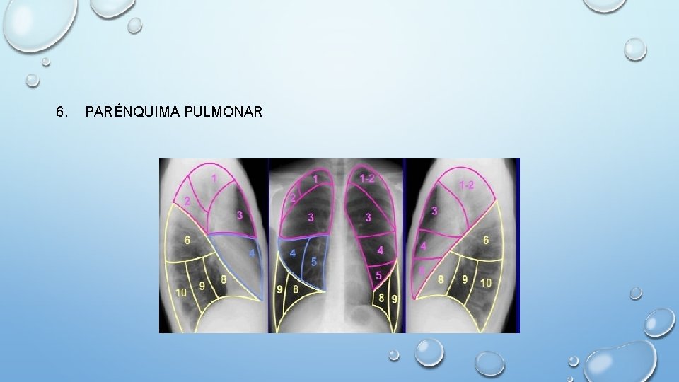6. PARÉNQUIMA PULMONAR 
