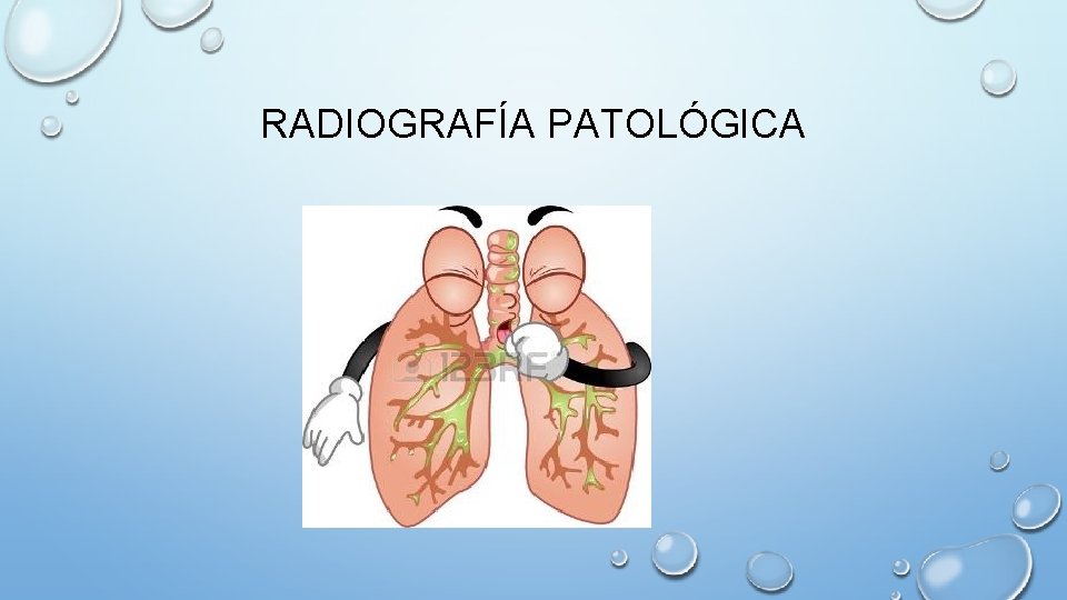 RADIOGRAFÍA PATOLÓGICA 