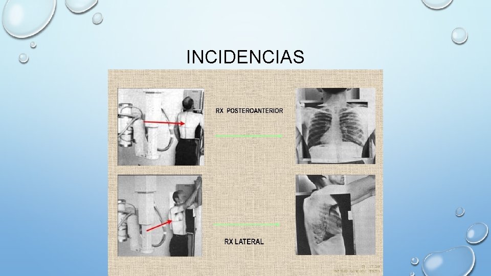 INCIDENCIAS 