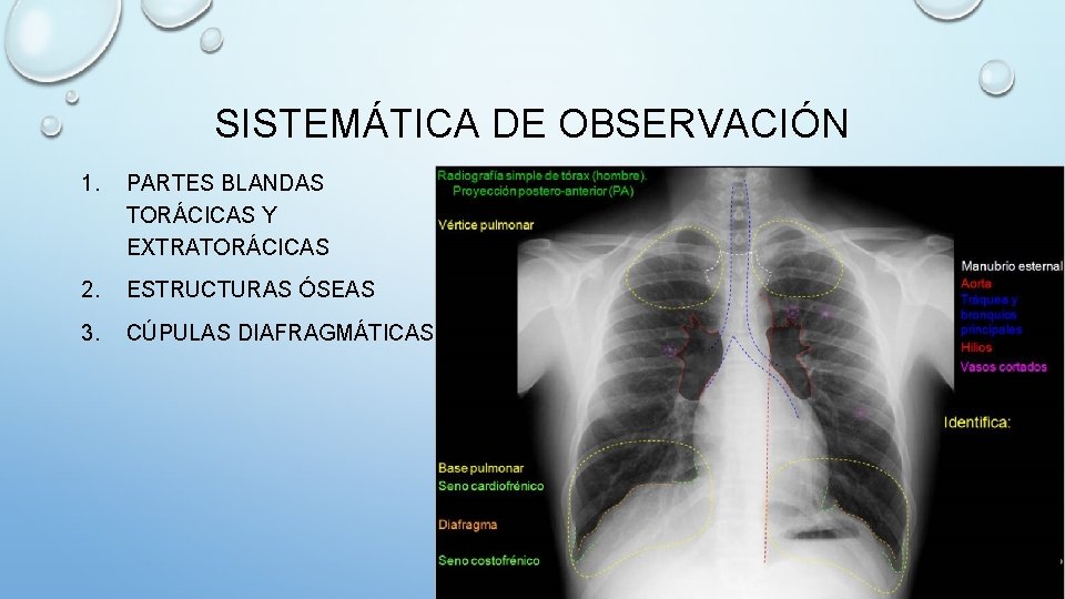 SISTEMÁTICA DE OBSERVACIÓN 1. PARTES BLANDAS TORÁCICAS Y EXTRATORÁCICAS 2. ESTRUCTURAS ÓSEAS 3. CÚPULAS
