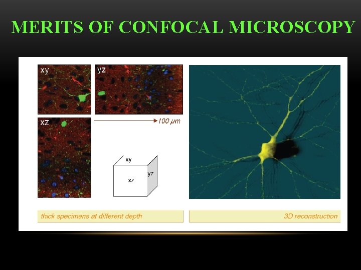 MERITS OF CONFOCAL MICROSCOPY 
