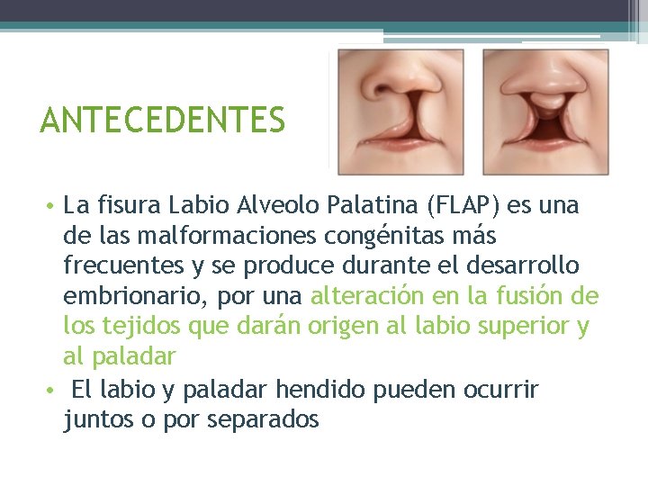 ANTECEDENTES • La fisura Labio Alveolo Palatina (FLAP) es una de las malformaciones congénitas