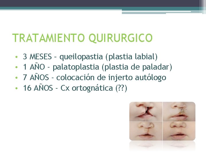 TRATAMIENTO QUIRURGICO • • 3 MESES – queilopastia (plastia labial) 1 AÑO - palatoplastia