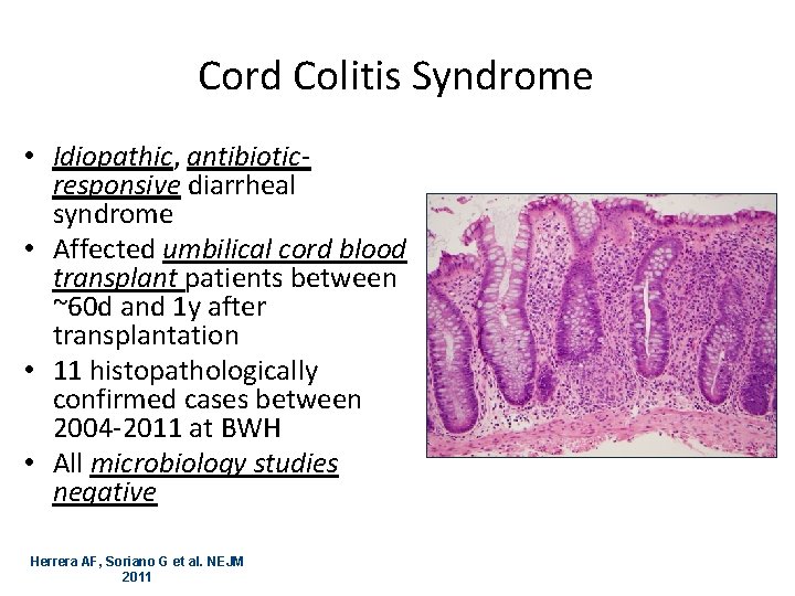 Cord Colitis Syndrome • Idiopathic, antibioticresponsive diarrheal syndrome • Affected umbilical cord blood transplant