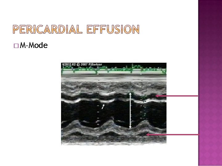 � M-Mode � M-Mode