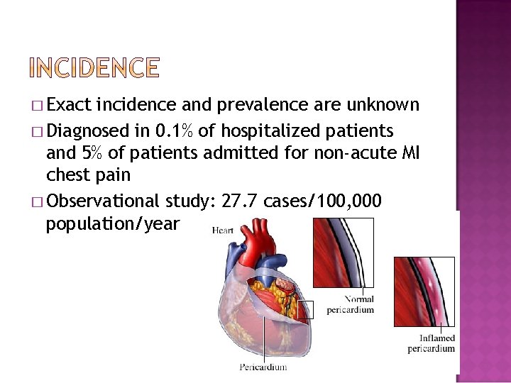 � Exact incidence and prevalence are unknown � Diagnosed in 0. 1% of hospitalized � Exact incidence and prevalence are unknown � Diagnosed in 0. 1% of hospitalized