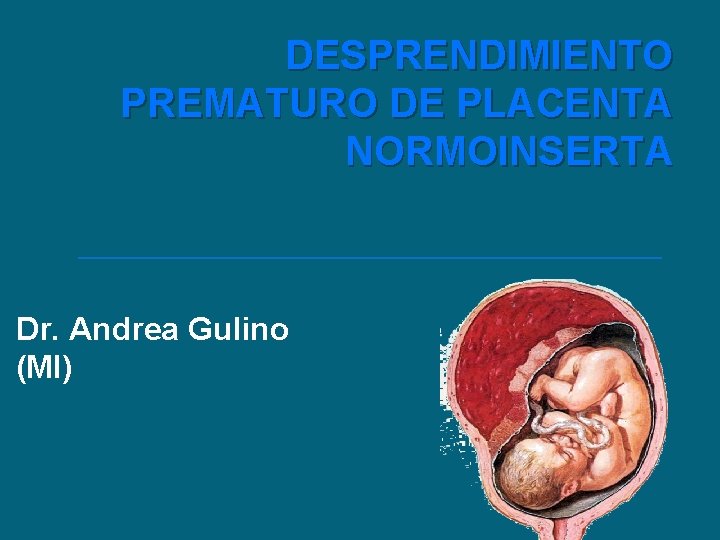 DESPRENDIMIENTO PREMATURO DE PLACENTA NORMOINSERTA Dr. Andrea Gulino (MI) 