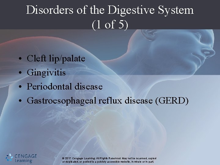 Disorders of the Digestive System (1 of 5) • • Cleft lip/palate Gingivitis Periodontal