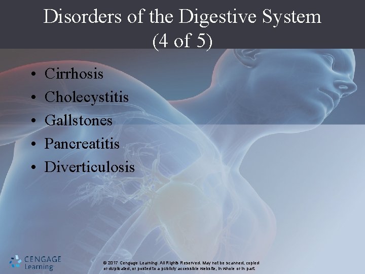 Disorders of the Digestive System (4 of 5) • • • Cirrhosis Cholecystitis Gallstones