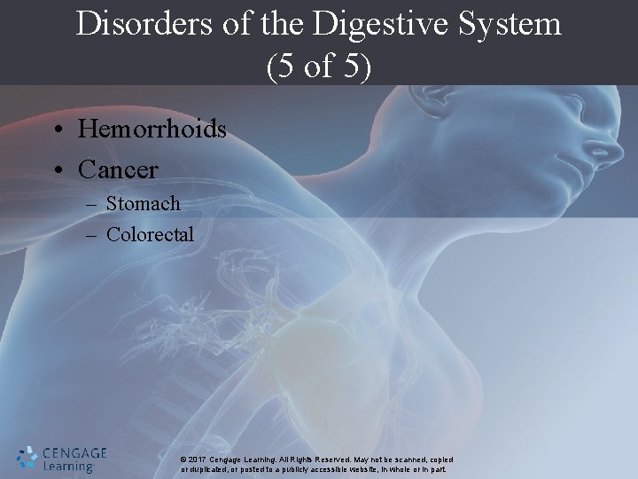 Disorders of the Digestive System (5 of 5) • Hemorrhoids • Cancer – Stomach
