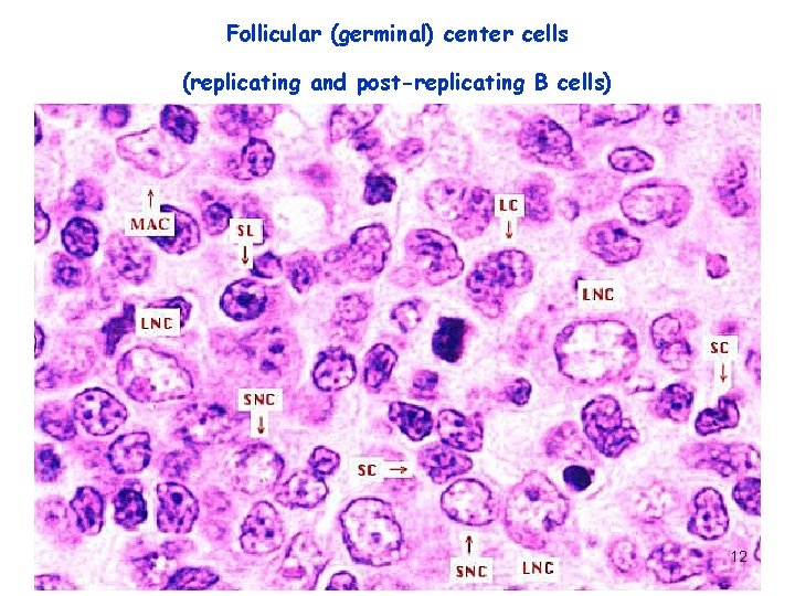 Follicular (germinal) center cells (replicating and post-replicating B cells) 12 