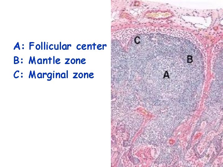 A: Follicular center B: Mantle zone C: Marginal zone 16 