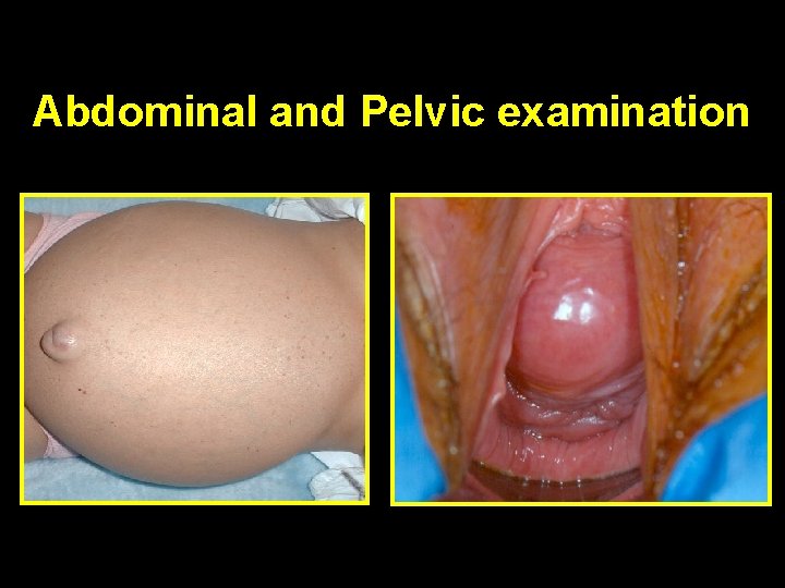 Abdominal and Pelvic examination 