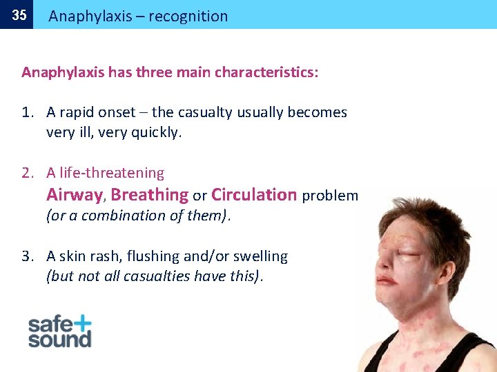 35 Anaphylaxis – recognition Anaphylaxis has three main characteristics: 1. A rapid onset –