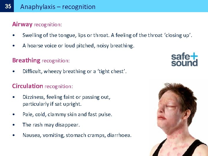 Anaphylaxis – recognition 35 Airway recognition: • Swelling of the tongue, lips or throat.