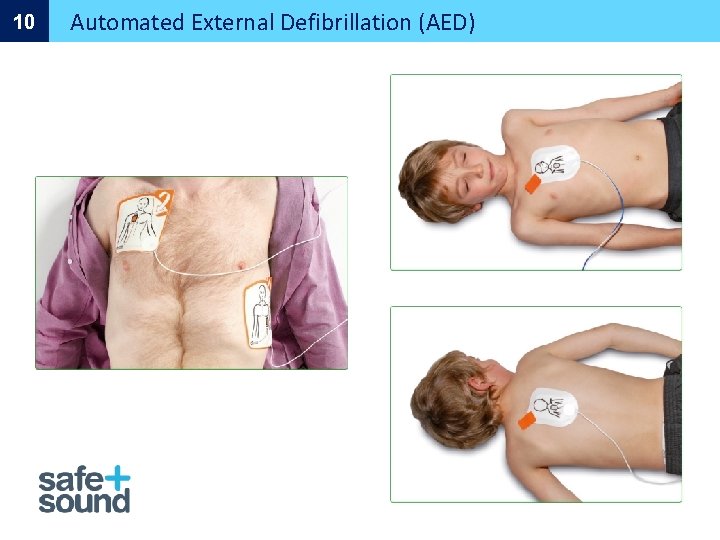 10 Automated External Defibrillation (AED) 