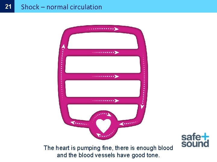 21 Shock – normal circulation The heart is pumping fine, there is enough blood