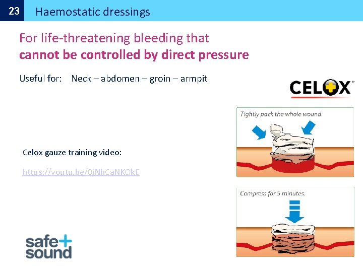 23 Haemostatic dressings For life-threatening bleeding that cannot be controlled by direct pressure Useful