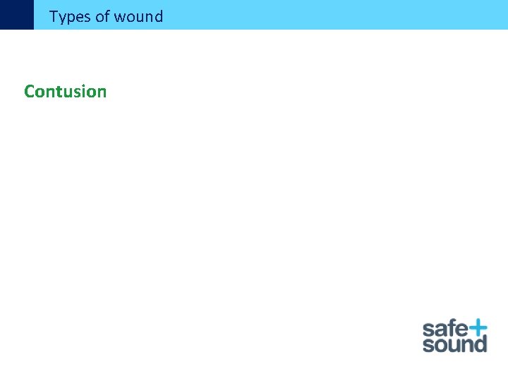 Types of wound Contusion 