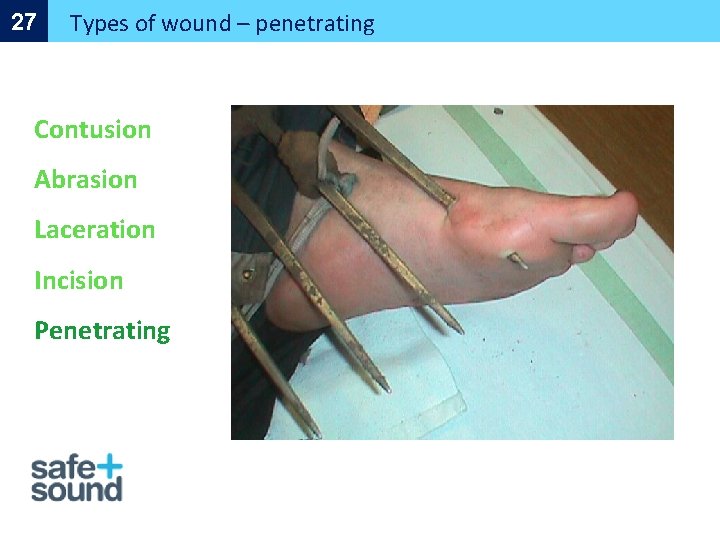 27 Types of wound – penetrating Contusion Abrasion Laceration Incision Penetrating 