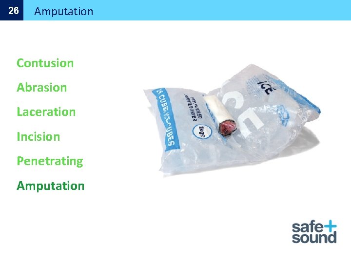 26 Amputation Contusion Abrasion Laceration Incision Penetrating Amputation 