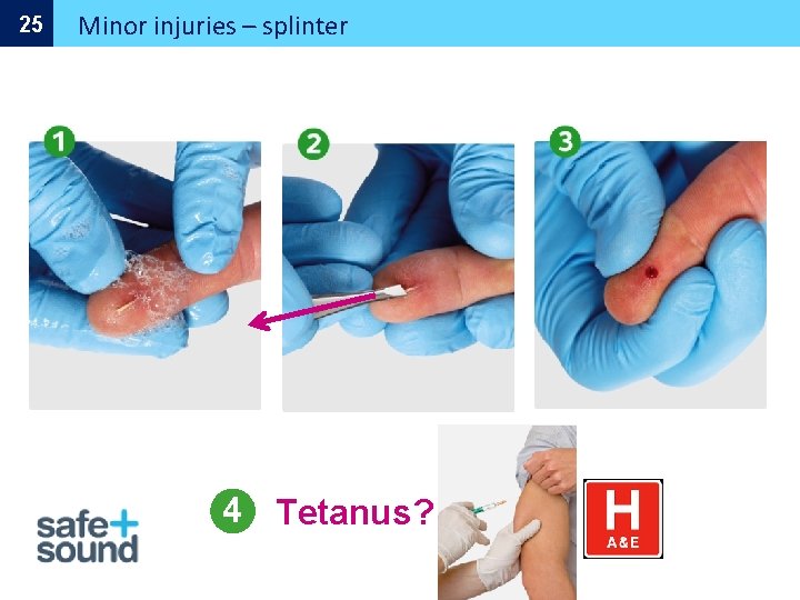 25 Minor injuries – splinter 4 Tetanus? 