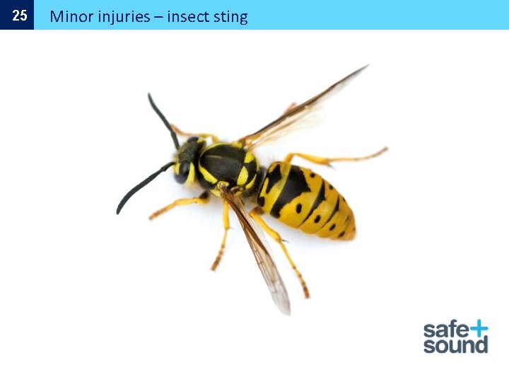 25 Minor injuries – insect sting 