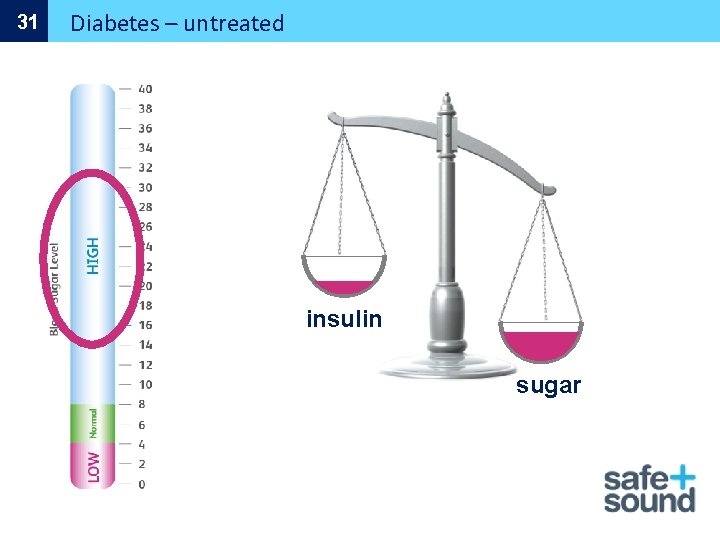 31 Diabetes – untreated insulin sugar 