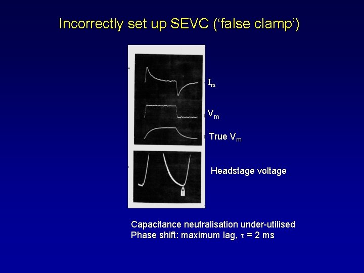 Incorrectly set up SEVC (‘false clamp’) Im Vm True Vm Headstage voltage Capacitance neutralisation