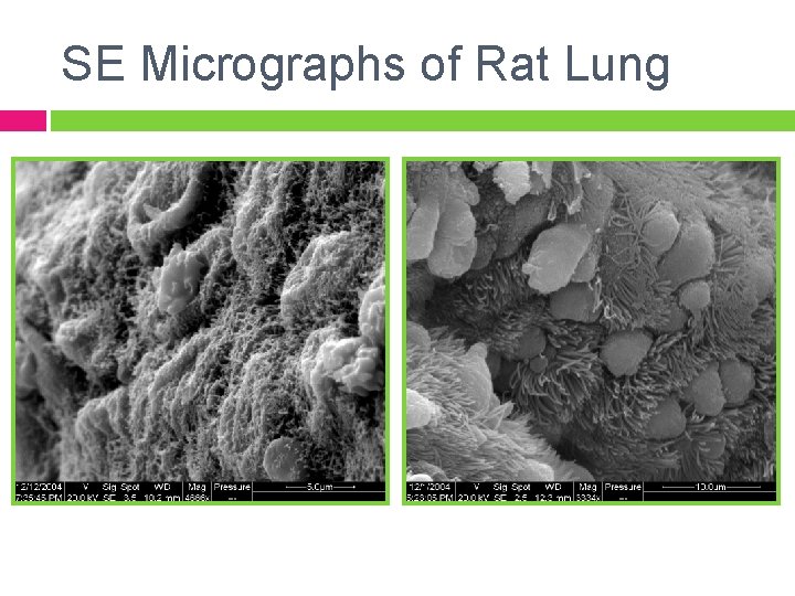 SE Micrographs of Rat Lung 