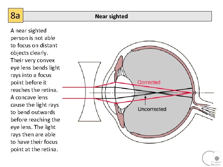 8 a A near sighted person is not able to focus on distant objects