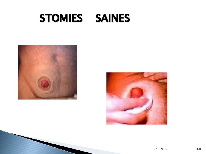 . . STOMIES SAINES 2/19/2021 63 