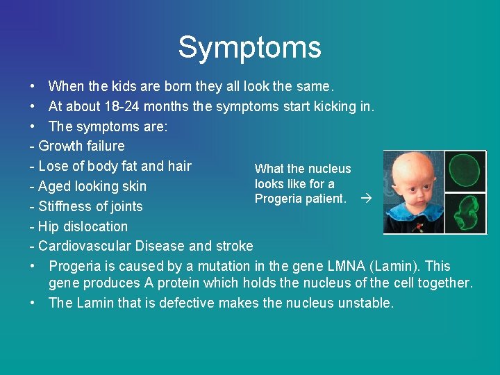 Symptoms • When the kids are born they all look the same. • At