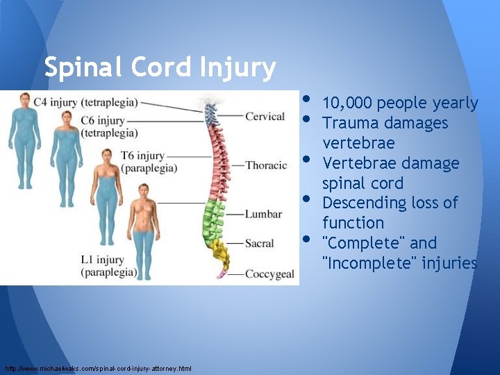 Spinal Cord Injury • • • http: //www. michaelwaks. com/spinal-cord-injury-attorney. html 10, 000 people
