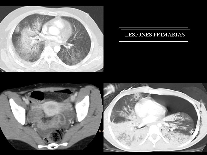 LESIONES PRIMARIAS 