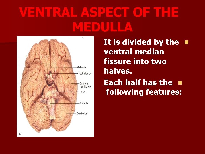 VENTRAL ASPECT OF THE MEDULLA It is divided by the n ventral median fissure