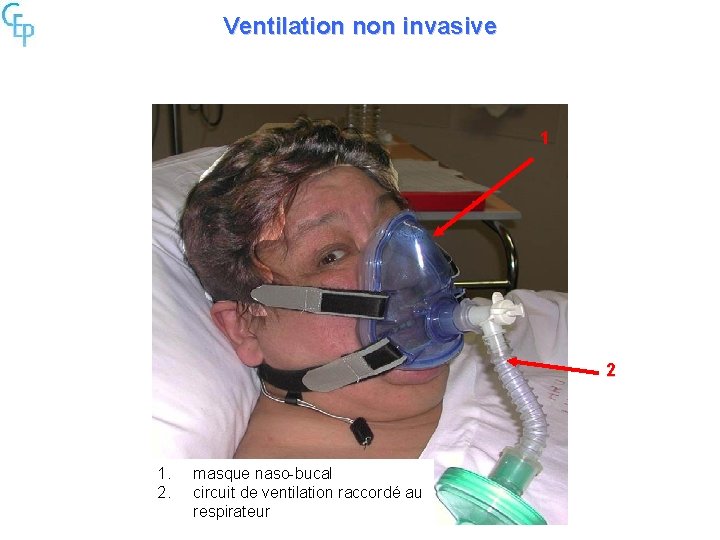 Ventilation non invasive 1 2 1. 2. masque naso-bucal circuit de ventilation raccordé au