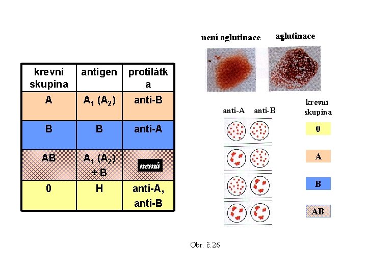 není aglutinace krevní skupina antigen protilátk a A A 1 (A 2) anti-B B