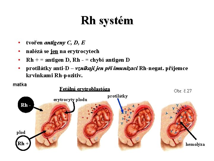 Rh systém • • tvořen antigeny C, D, E nalézá se jen na erytrocytech