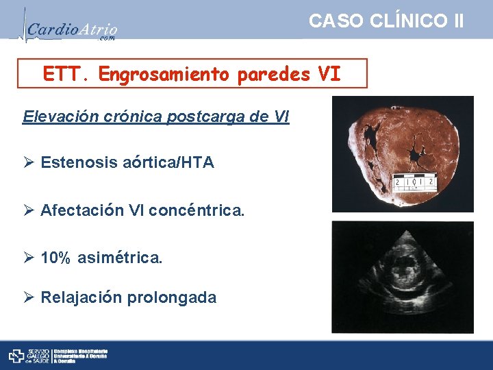 CASO CLÍNICO II ETT. Engrosamiento paredes VI Elevación crónica postcarga de VI Ø Estenosis