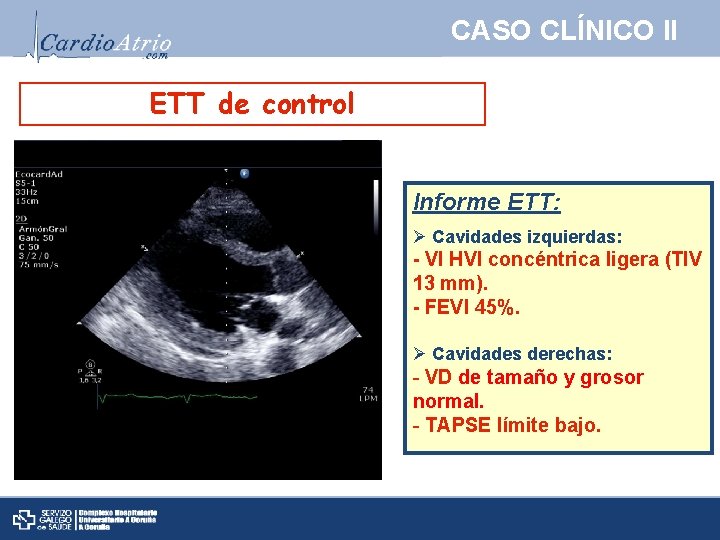 CASO CLÍNICO II ETT de control Informe ETT: Ø Cavidades izquierdas: - VI HVI