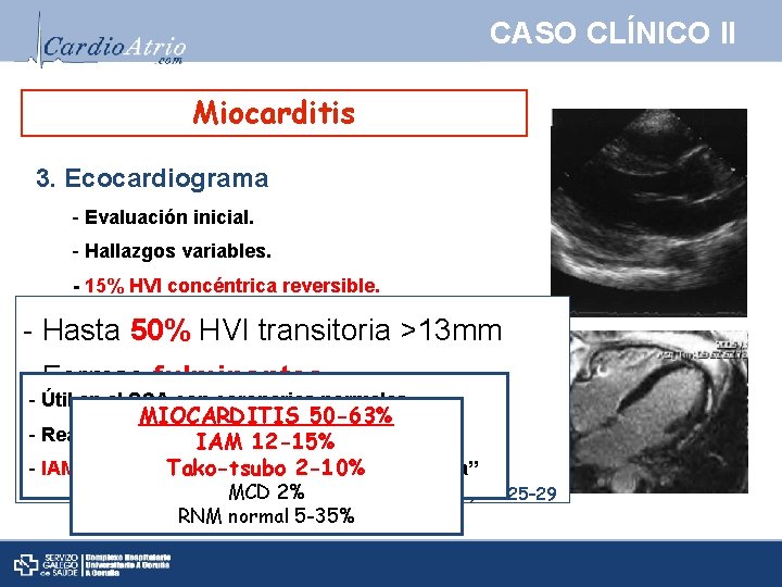 CASO CLÍNICO II Miocarditis 3. Ecocardiograma - Evaluación inicial. - Hallazgos variables. - 15%