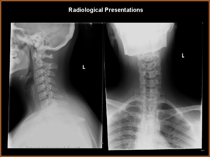 Radiological Presentations 