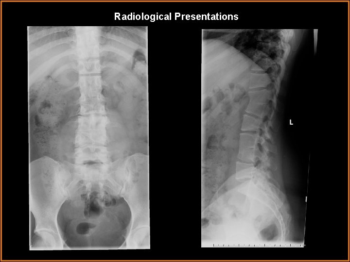 Radiological Presentations 