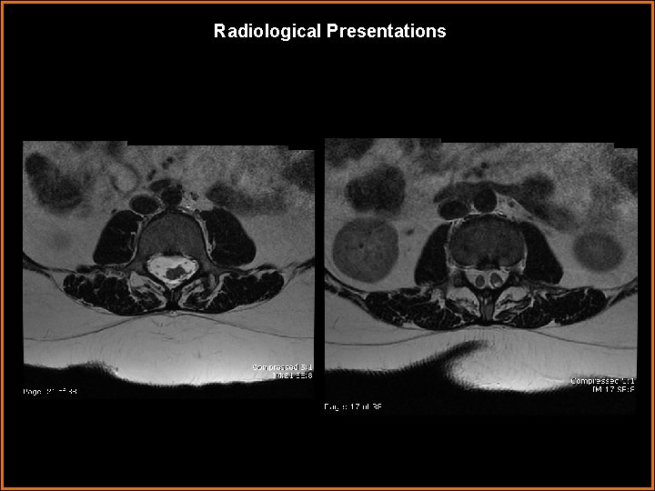 Radiological Presentations 