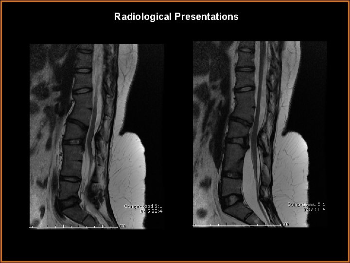 Radiological Presentations 